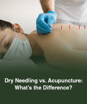 Dry Needling vs. Acupuncture: What's the Difference?